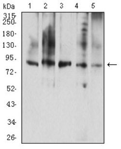 G-CSFR/CD114 Antibody (8F8B12) - BSA Free, Novus Biologicals 0.1 ml; Unconjugated:Antibodies,